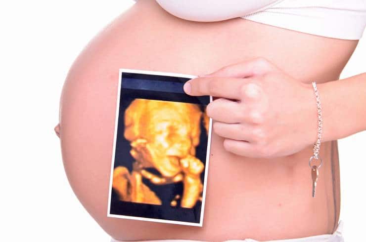 Womb with a View